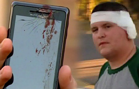 Smartphone explode na orelha durante uma chamada!