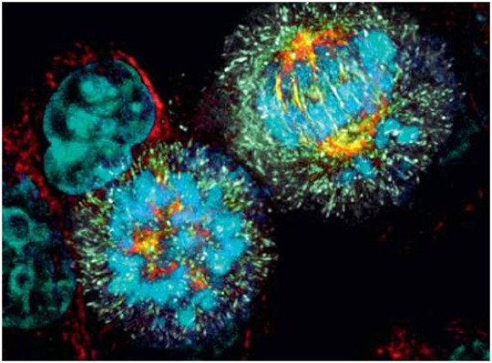 cancro (1)