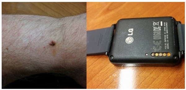 lg_watch_00
