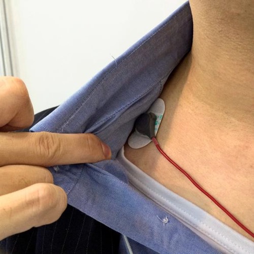 20150129_epilepsy_sensor_article_main_image