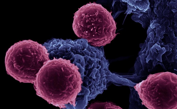 Há um novo sensor capaz de detectar cancro pelo hálito