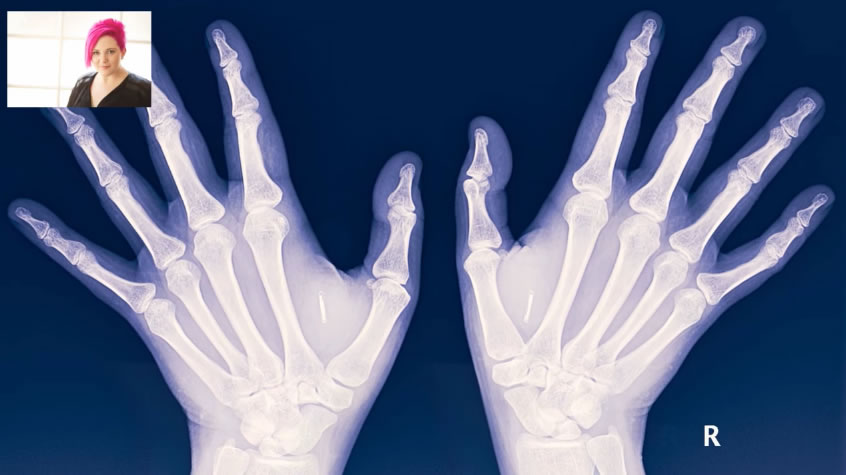 Biohacking – Implantes de chips dão super poderes… ou quase!
