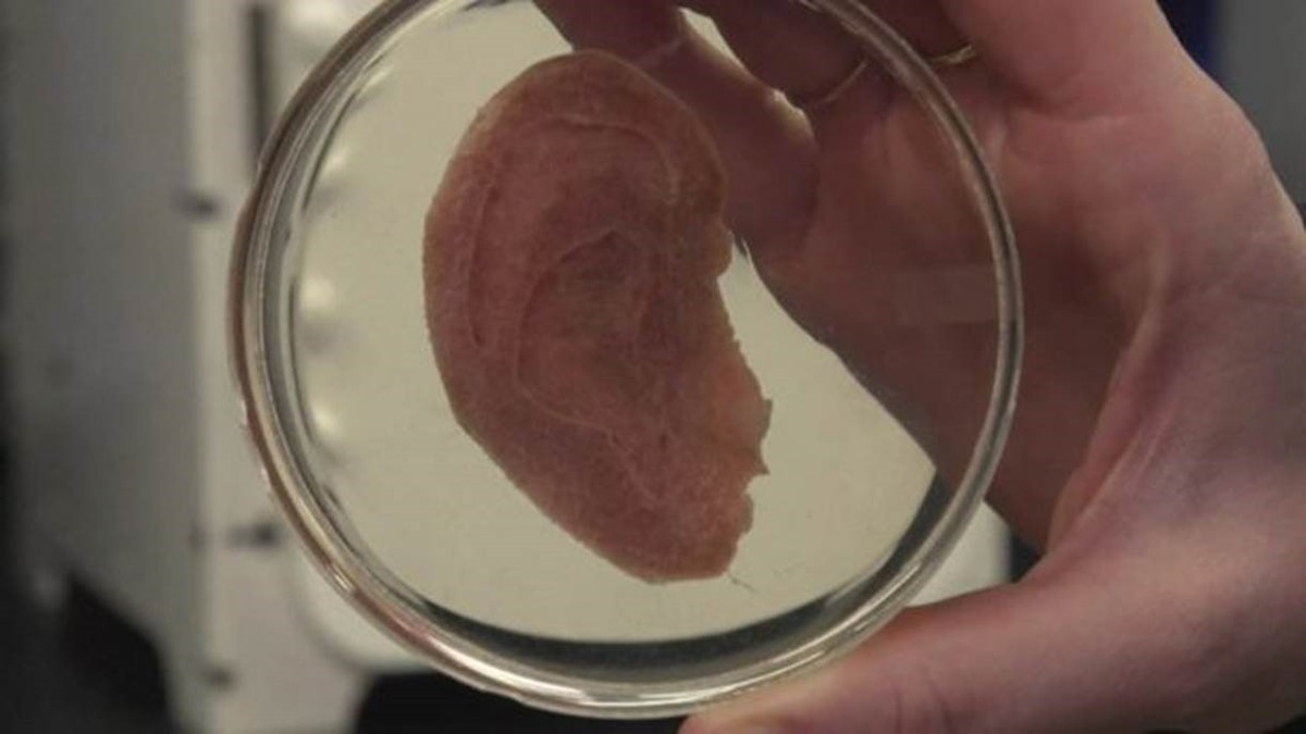 Cientistas usam maçã e criam tecido humano para transplante