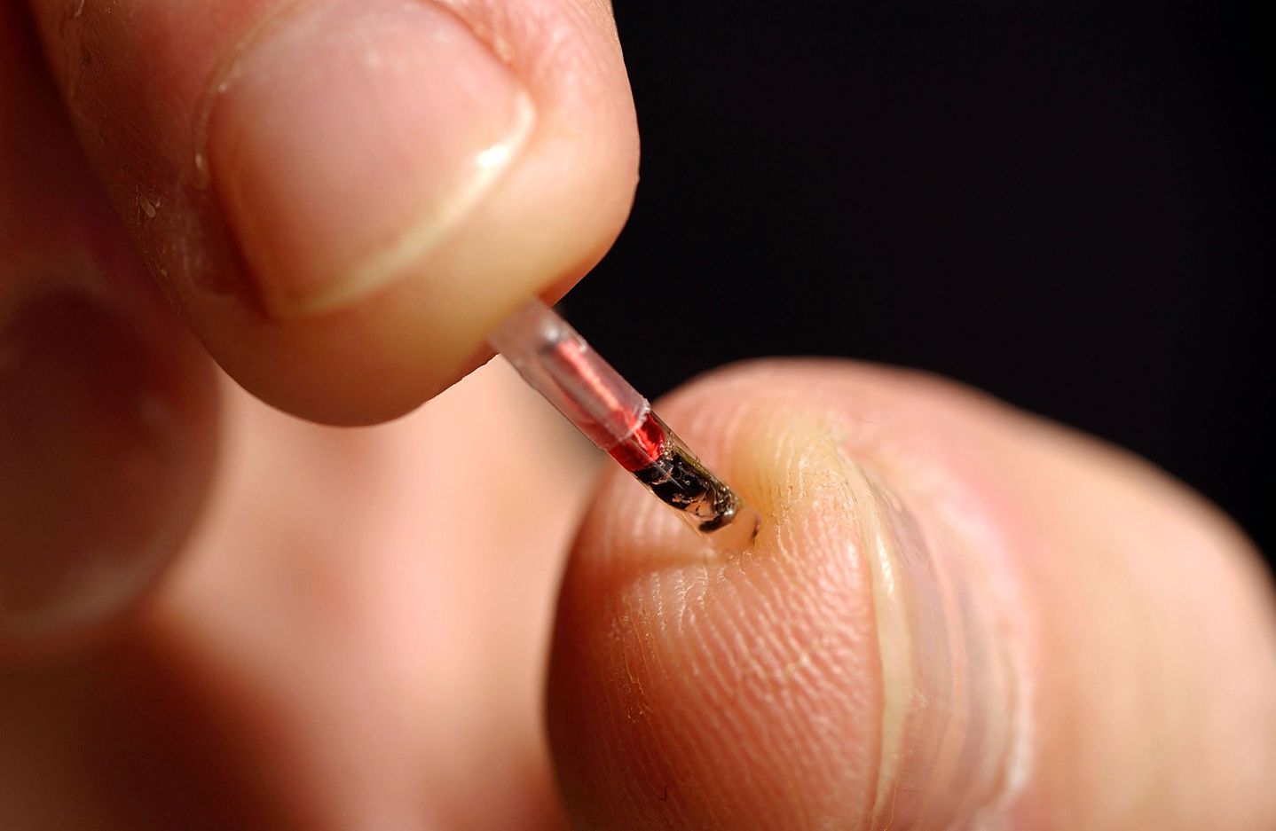 É real: Empresa implanta microchip nos funcionários