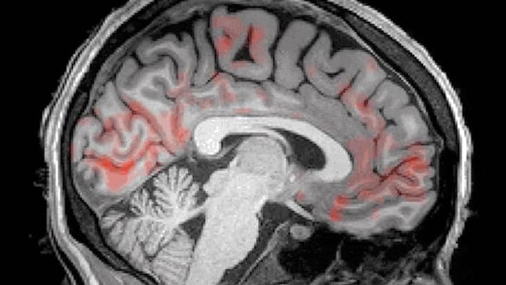 Sabia que o seu cérebro é lavado, literalmente, durante o sono? (vídeo)