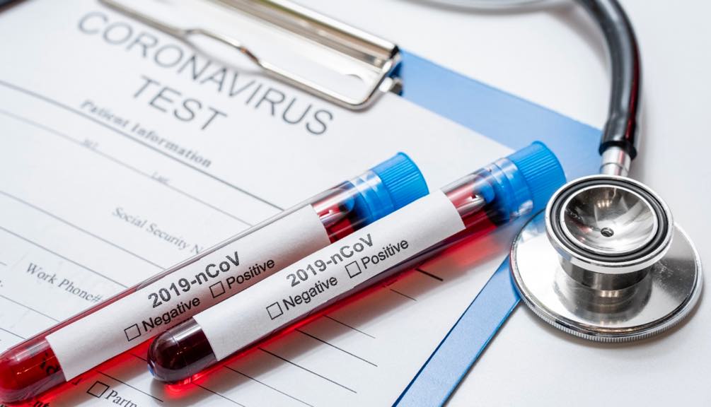 COVID-19: Tem sintomas? Instale esta app para os médicos o ajudarem