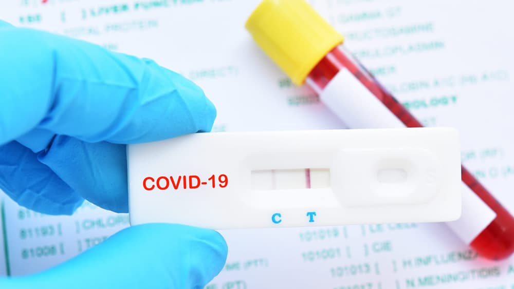 COVID-19: Novo teste de anticorpos com 99% de precisão aprovado para utilização na Europa