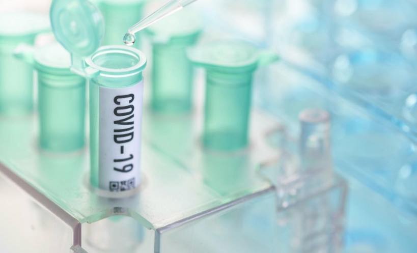 COVID-19: Quais os testes de diagnóstico que se podem realizar?