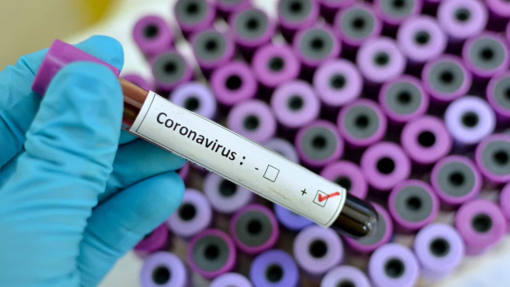 Coronavírus está a desaparecer “demasiado rápido”? Oxford diz que sim…