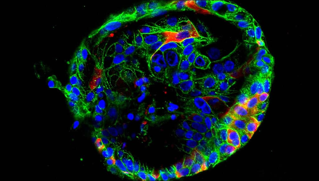 Estudos em mini órgãos explicam o comportamento do novo coronavírus no corpo