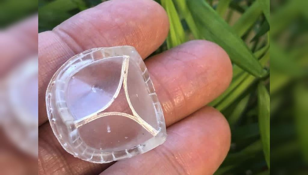 Nova válvula cardíaca poderá acabar com cirurgia de coração aberto a muitos doentes
