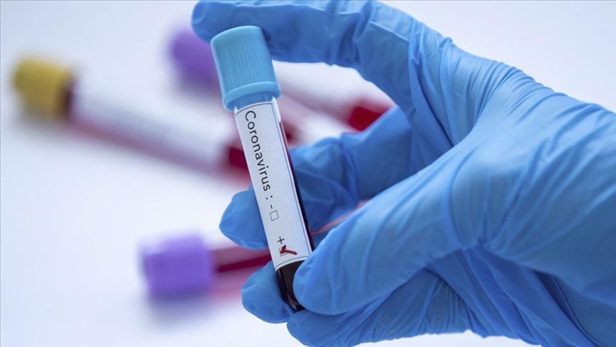 COVID-19: Rússia já anunciou a produção do primeiro lote de vacina