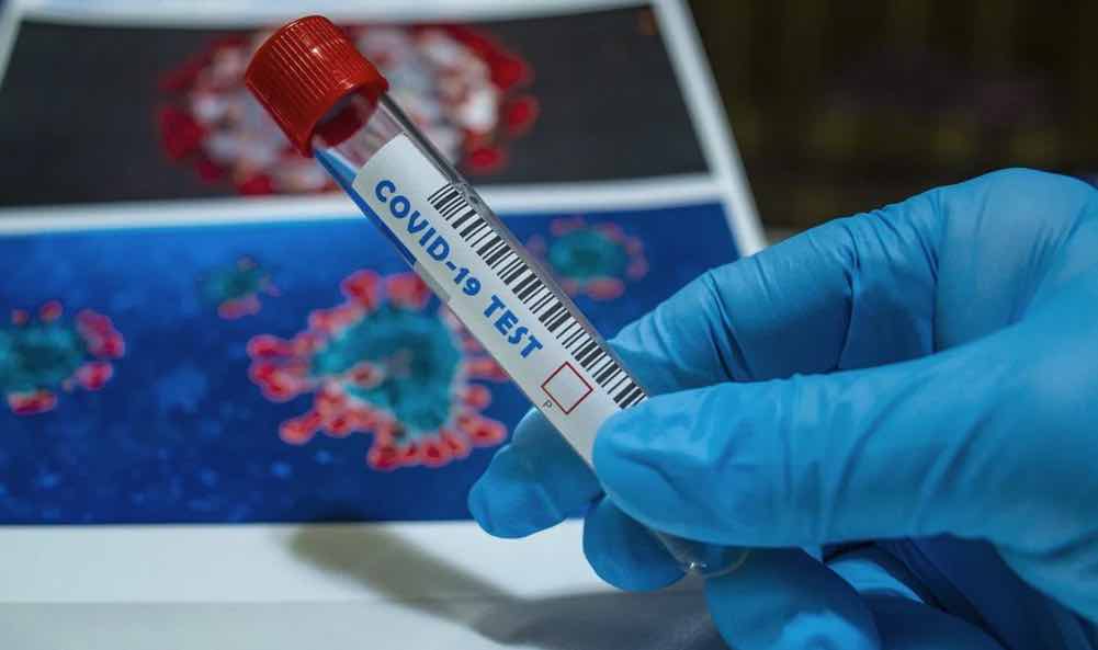 COVID-19: Cada boletim epidemiológico custa cerca de 400 euros