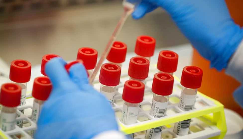 COVID-19: Testes de antigénio com resultado entre 10 a 30 minutos