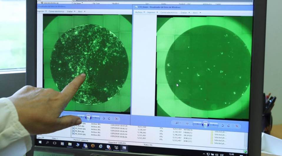 COVID-19: medicamento espanhol reduz a quase 100% carga viral