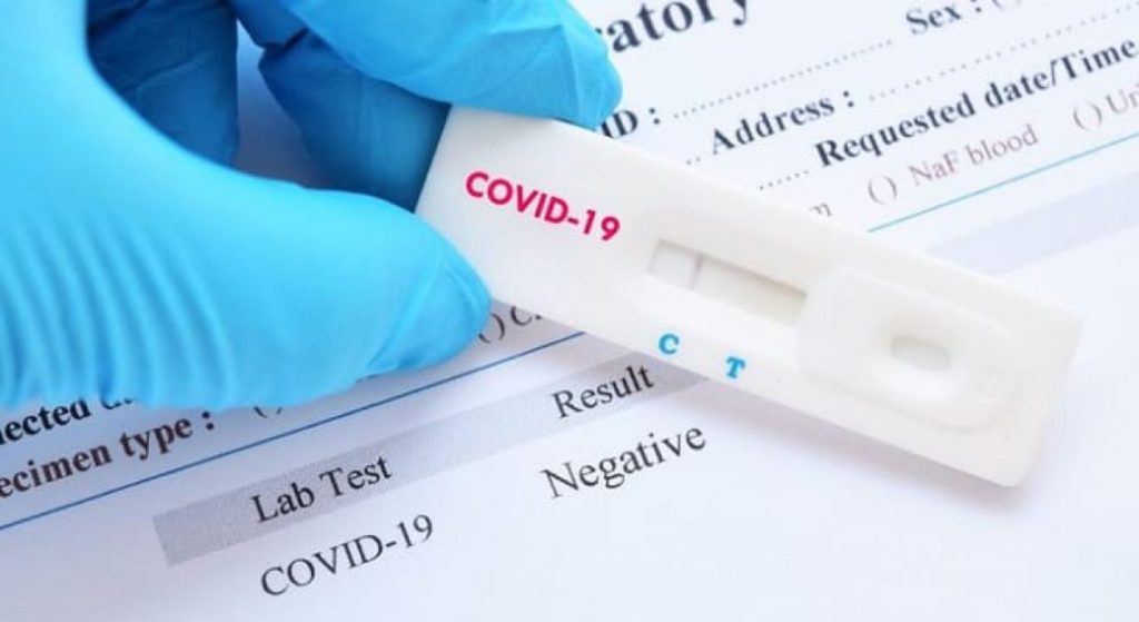 COVID-19: Qual o preço dos testes rápidos vendidos nos supermercados?
