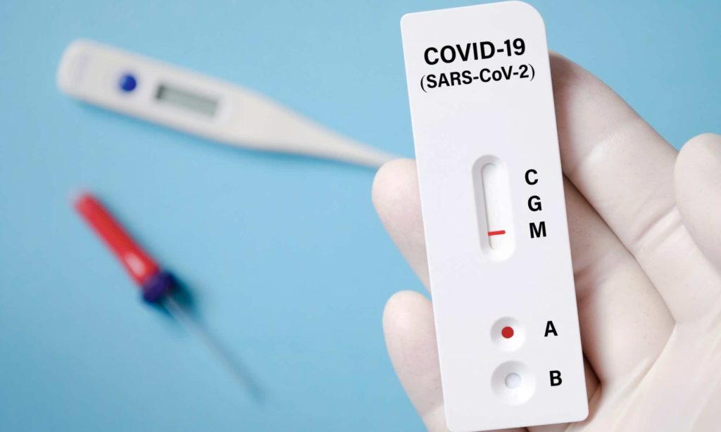 COVID-19: Testes deixam de ser gratuitos a partir de domingo