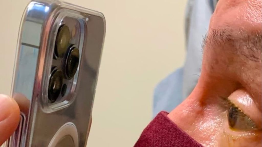 Médico usa câmara do iPhone 13 Pro para tirar imagens macro dos olhos de paciente