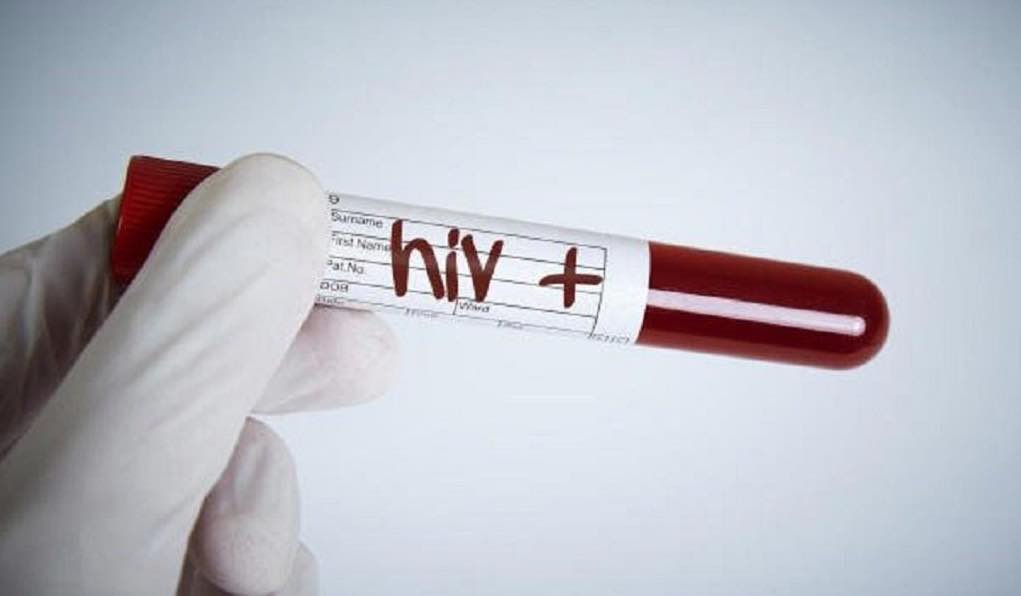 É a segunda vez que acontece! Mulher curou-se do VIH sem medicação