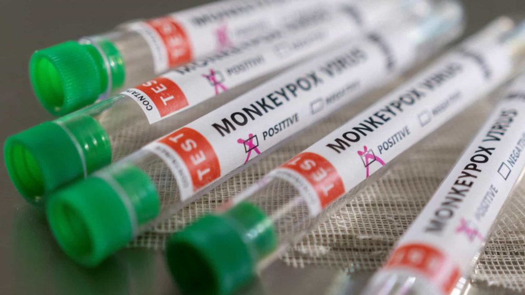 Monkeypox: Portugal tem confirmados já 119 casos