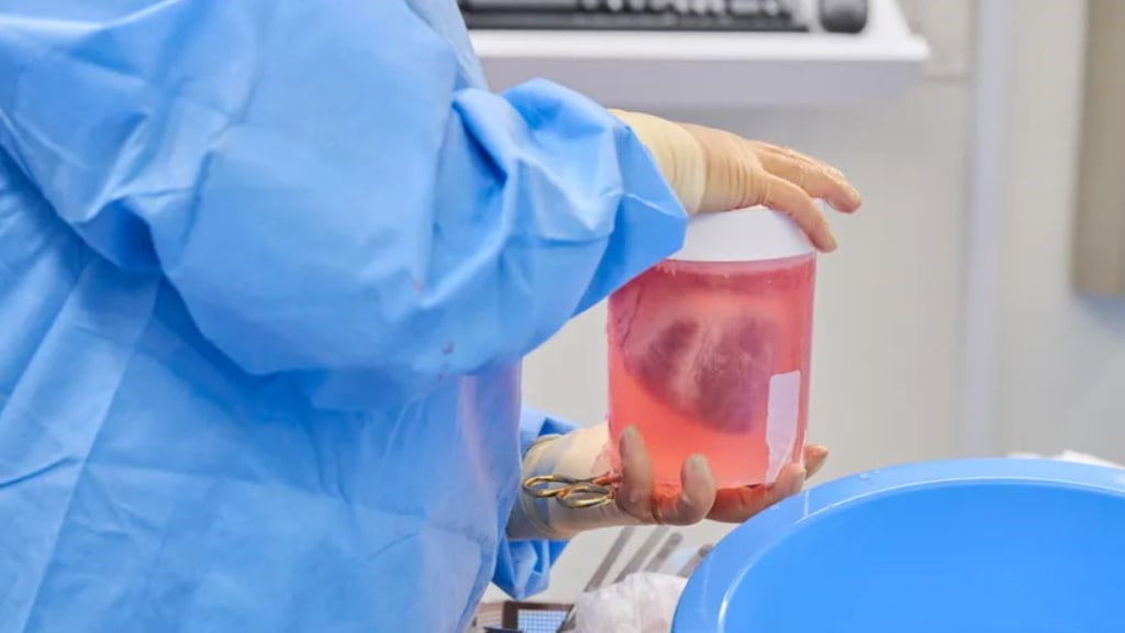 Corações de porco geneticamente alterados transplantados para o corpo de pessoas mortas
