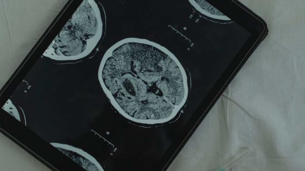 Pela primeira vez, criança de 13 anos é curada de um cancro cerebral mortal