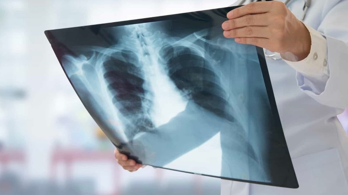 Um facto preocupante… Cancro nos jovens aumentou quase 80% em 30 anos