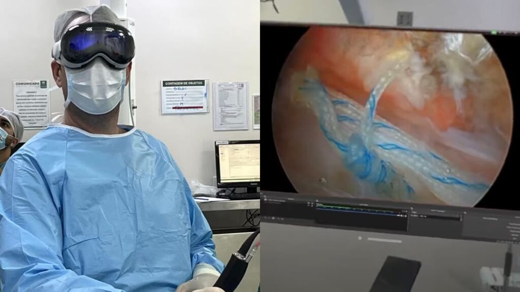 Apple Vision Pro utilizado para ajudar médico durante cirurgia ao ombro no Brasil