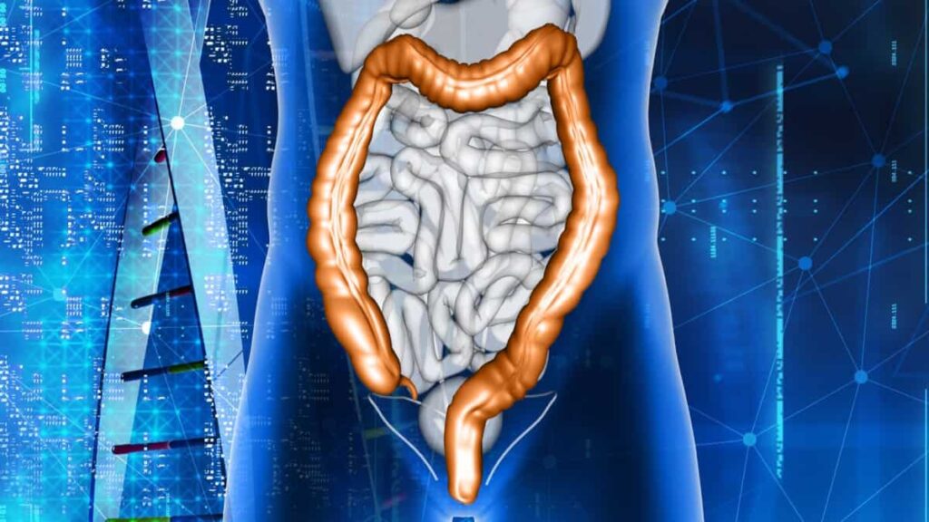 Estudo associa o aumento dos cancros do intestino a estes hábitos alimentares