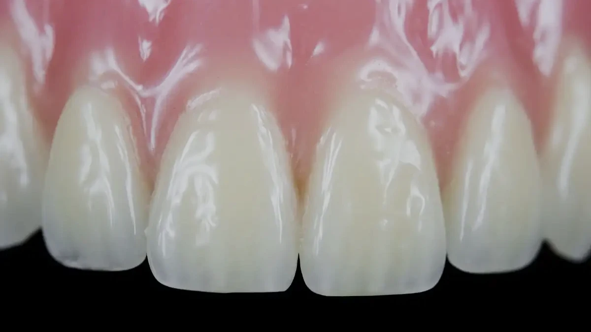 Cientistas afirmam ter descoberto uma maneira de regenerar o esmalte dentário